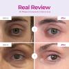 imageDrMelaxin CEMENRETE EYE CREAM