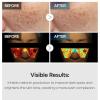 imageTX Tranexamic Acid Care Line TX creamTonerAmpouleCleanser Powerful Dark Spot Care  Visible Improvement in 48 Weeks