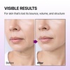 image:imageDrMelaxin Calcium Bonding Serum with REBORNIC 10000ppm Firming amp Volumizing Serum for Sagging Skin Calcium Complex amp Collagen for Elasticity amp Skin Density 169 floz