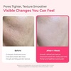 image:imageDrMelaxin MultiCare Duo Set  Collagen Multi Balm Stick  Cyano Pink Spicule Serum Korean Skincare for Dark Circles Wrinkles Enlarged Pores amp Texture Refining Niacinamide Vitamin B12 2 Piece