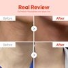 image:imageDrMelaxin Necksphalt ECM Neck Lifting Duo  Necksphalt ECM Neck Cream 50ml  Neck Ampoule 15ml x 10  Firming Elasticity amp Wrinkle Care