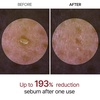 image:imageDrMelaxin Peel Shot Exfoliating TX Serum 80ml  99 Pure Tranexamic Acid amp Niacinamide  AHA PHA Brightening Exfoliating for Uneven Skin Tone Dark Spots amp Dullness  Smooth  Korean SkincareWhite Rice