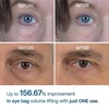 image:imageDrMelaxin Retinol Eyebag Cream for Puffiness Dark Circles amp Fine Lines Wrinkle EGF AntiAging Under Eye Moisturizer with NiacinamideampCeramide Makeup friendly korean skin careNiacinamide
