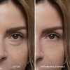 image:imageDrMelaxin Retinol Eyebag Cream for Puffiness Dark Circles amp Fine Lines Wrinkle EGF AntiAging Under Eye Moisturizer with NiacinamideampCeramide Makeup friendly korean skin careRetinol
