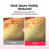 image:imageDrMelaxin TX Astaxanthin Melanin Recovery amp Firming Hydrogel Mask 4 Sheets  Dark Spot Correcting 2Step Mask with Tranexamic Acid Niacinamide PDRN amp Collagen for ElasticityTXA