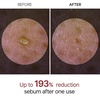 image:imageDr Melaxin Peel Shot Kojic Acid Turmeric Serum  Exfoliating Dark Spot Corrector with AHABHA amp Niacinamide Brightening amp Even Tone Facial Serum 80ml  270 fl ozWhite Rice